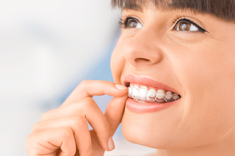 CandidPro™ Clear Aligners in Altamonte Springs