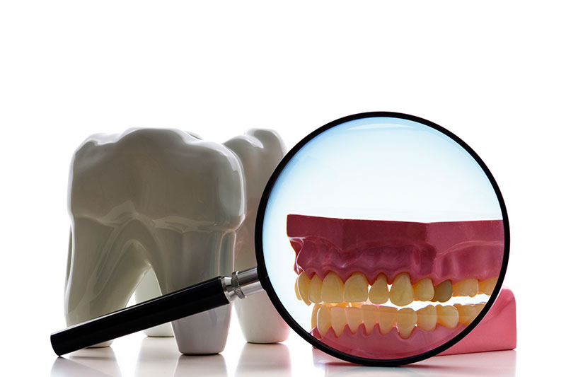 Root Canal Treatment in Altamonte Springs