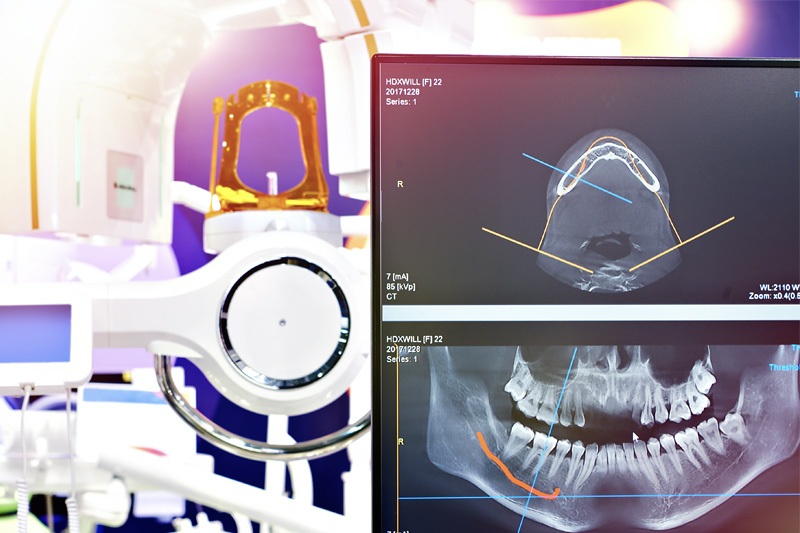 Digital X-Rays in Altamonte Springs