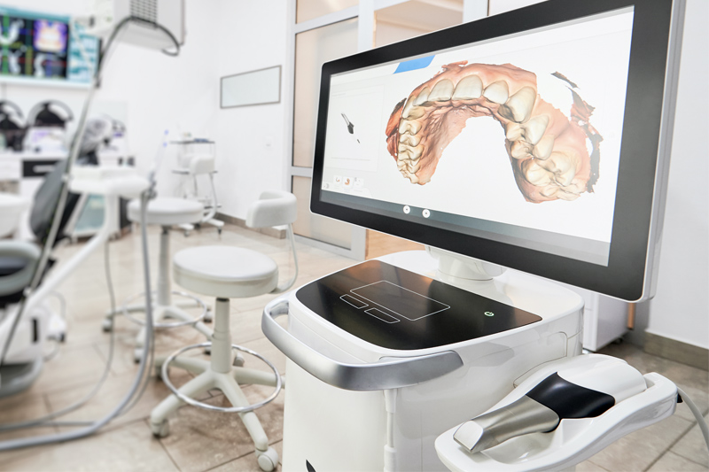 Intra-Oral Scanner in Altamonte Springs
